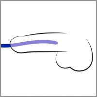 Стимулятори уретри You2Toys Silicone Dilator Set хвилеподібної форми, сині, 3 шт.