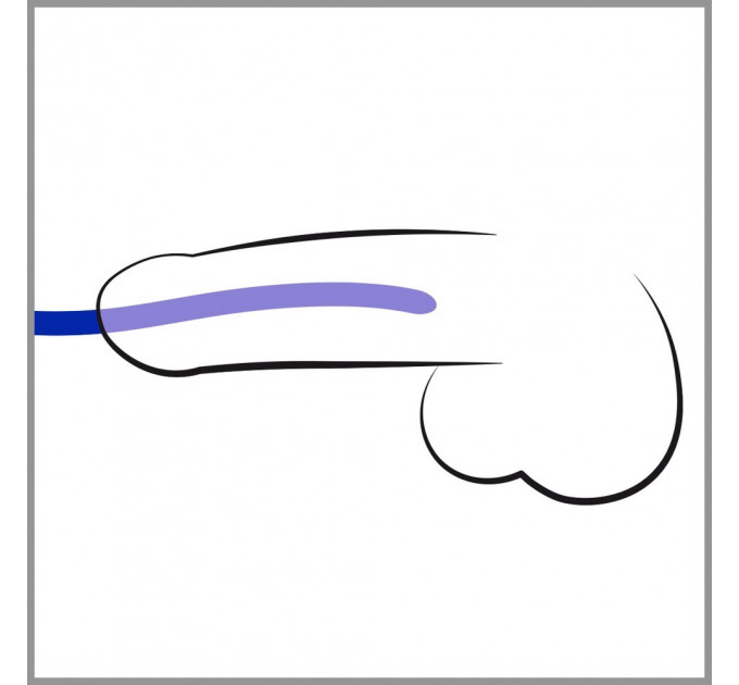 Стимуляторы уретры You2Toys Silicone Dilator Set волнообразной формы, синие, 3 шт.