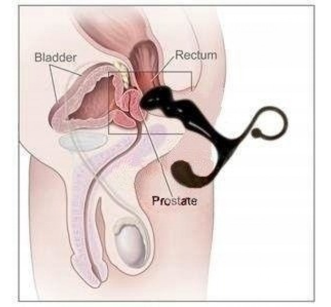 Масажер простати ToyJoy Power Plug Prostate Massager, червоний